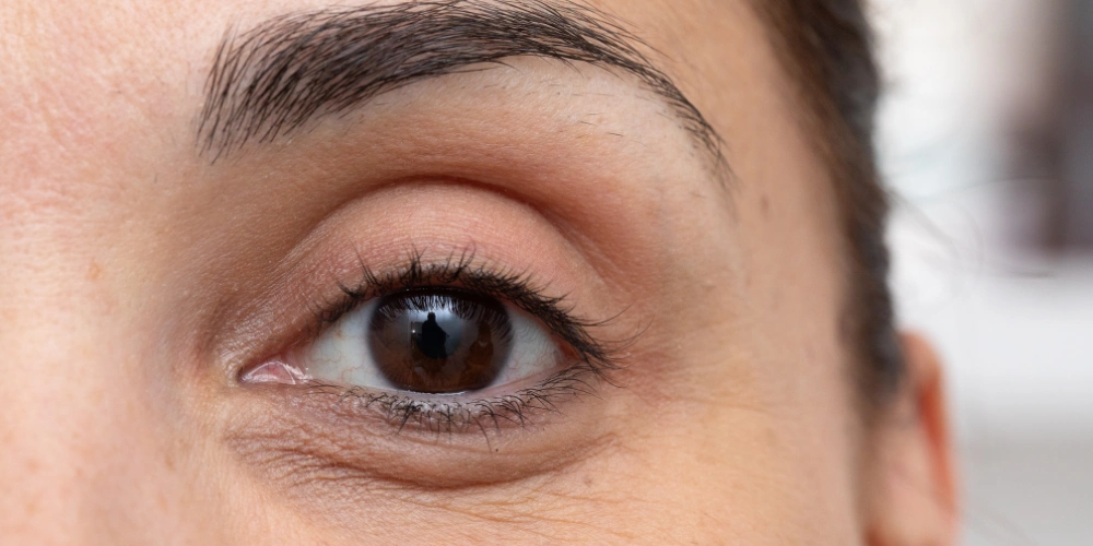 How can I naturally improve skin elasticity?