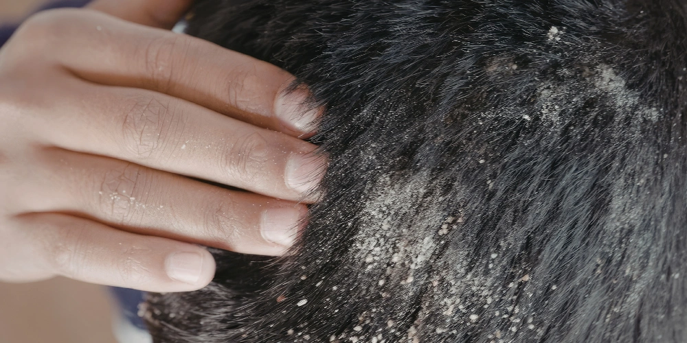 What are the best natural remedies for itchy scalp?