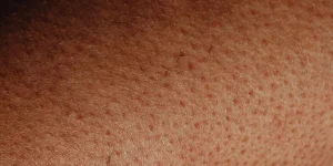 How can I get soft and plump skin naturally?